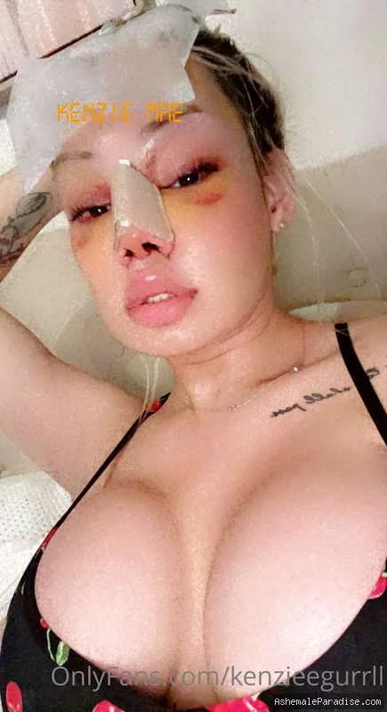 Kenzie Mae — Kenzie Mae — 6 fotos — OnlyFans Photos